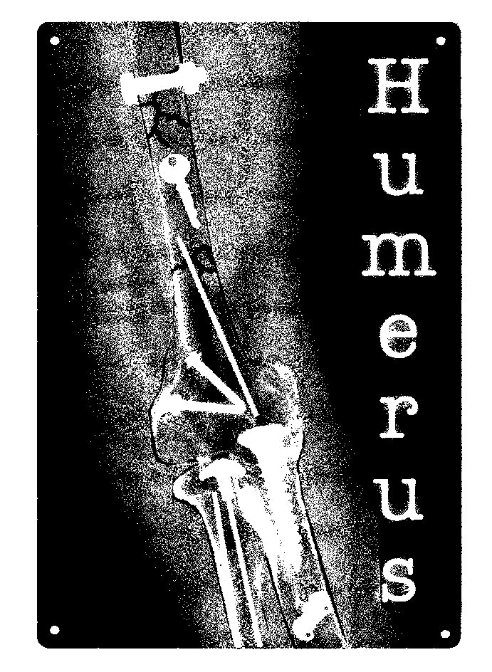 Trademark Logo HUMERUS