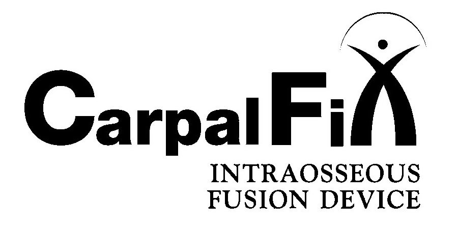 Trademark Logo CARPALFIX INTRAOSSEOUS FUSION DEVICE